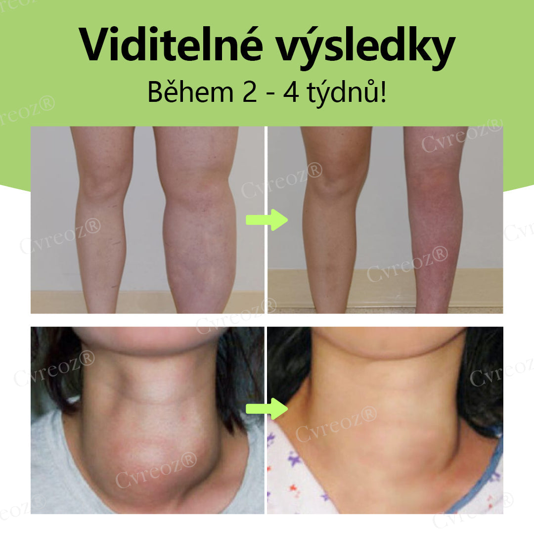 Cvreoz® Kräuter-Lymph-Entgiftungscreme schützt Ihre Gesundheit