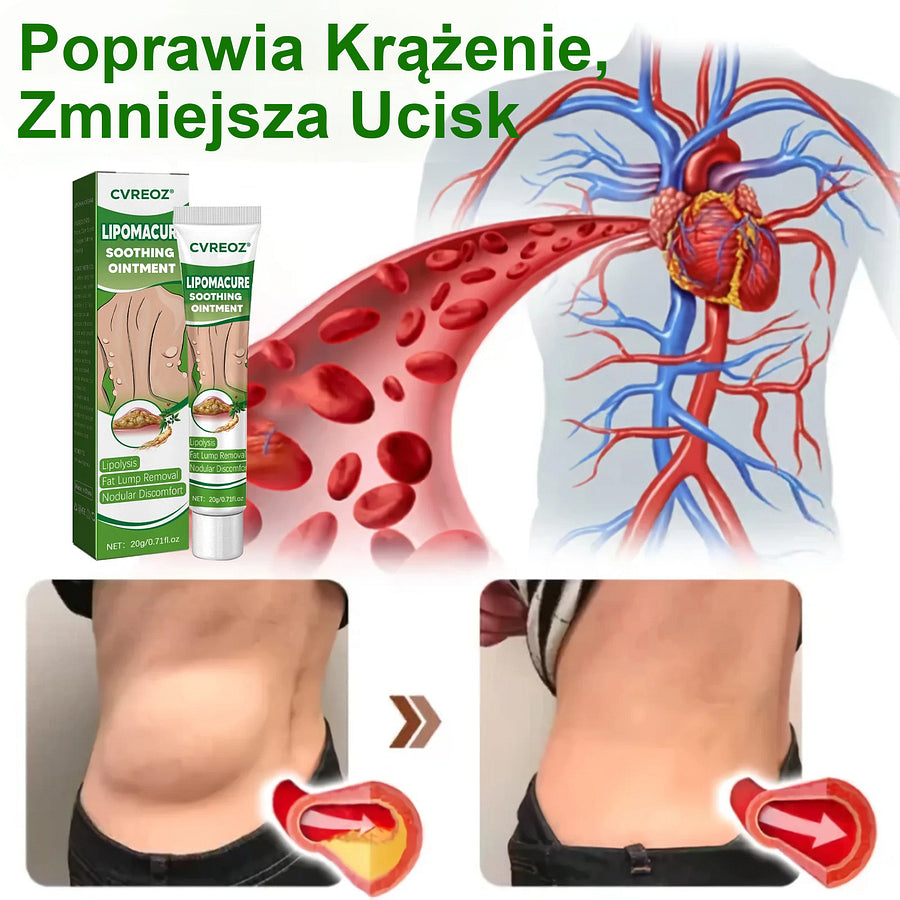 Cvreoz® Soothing Ointment behandelt Lipome problemlos und erzielt innerhalb von 2 Wochen eine deutliche Verbesserung