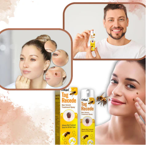 👨⚕️ILDS-Recommend 🟢 🐝TagRecede Bee venom Anti-Wart and Skin Treatment Spray💨