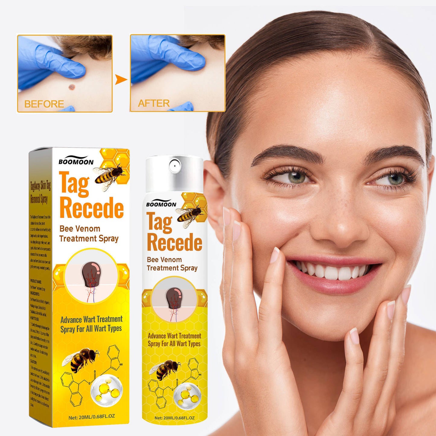 👨⚕️ILDS-Recommend 🟢 🐝TagRecede Bee venom Anti-Wart and Skin Treatment Spray💨