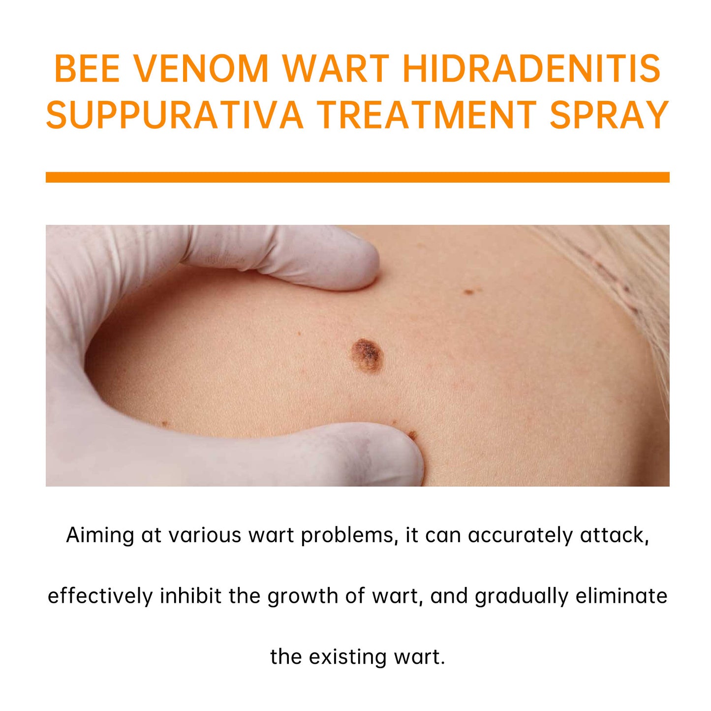 👨⚕️ILDS-Recommend 🟢 🐝TagRecede Bee venom Anti-Wart and Skin Treatment Spray💨