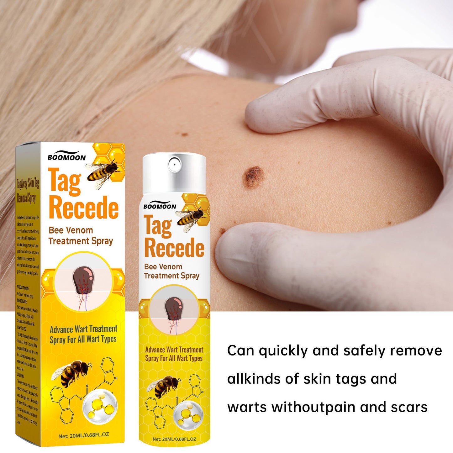 👨⚕️ILDS-Recommend 🟢 🐝TagRecede Bee venom Anti-Wart and Skin Treatment Spray💨