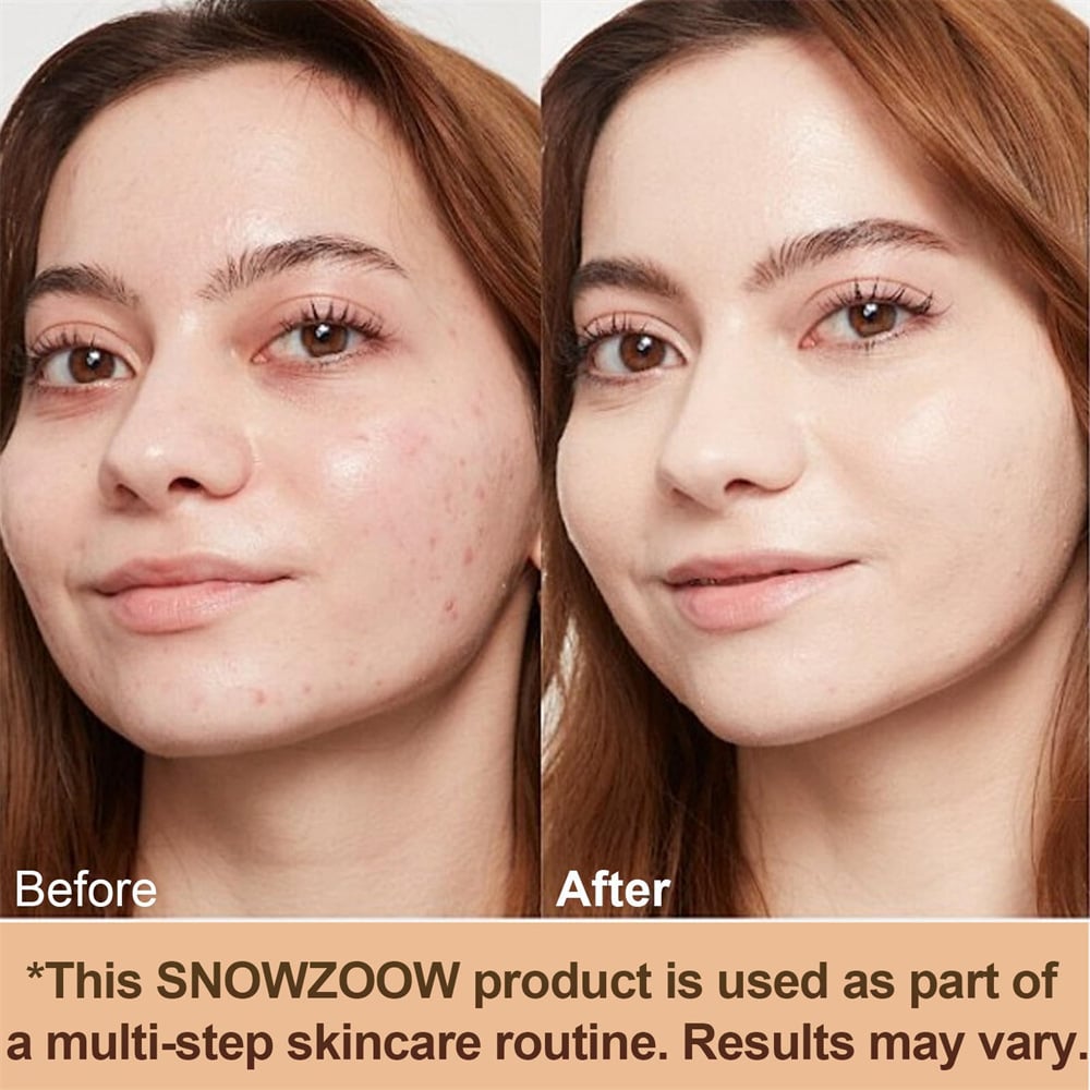 🔥Das heißeste Produkt von TikTok🔥 Feuchtigkeitsspendende 4-in-1-Concealer-Foundation – bionische Farbveränderung im mittleren Spektrum, langanhaltendes Make-up
