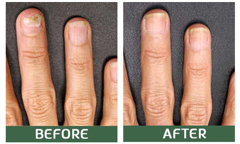 LOVILDSTM Chipikiri Chekudzivirira Nyuchi Uturu Kurapa Serum