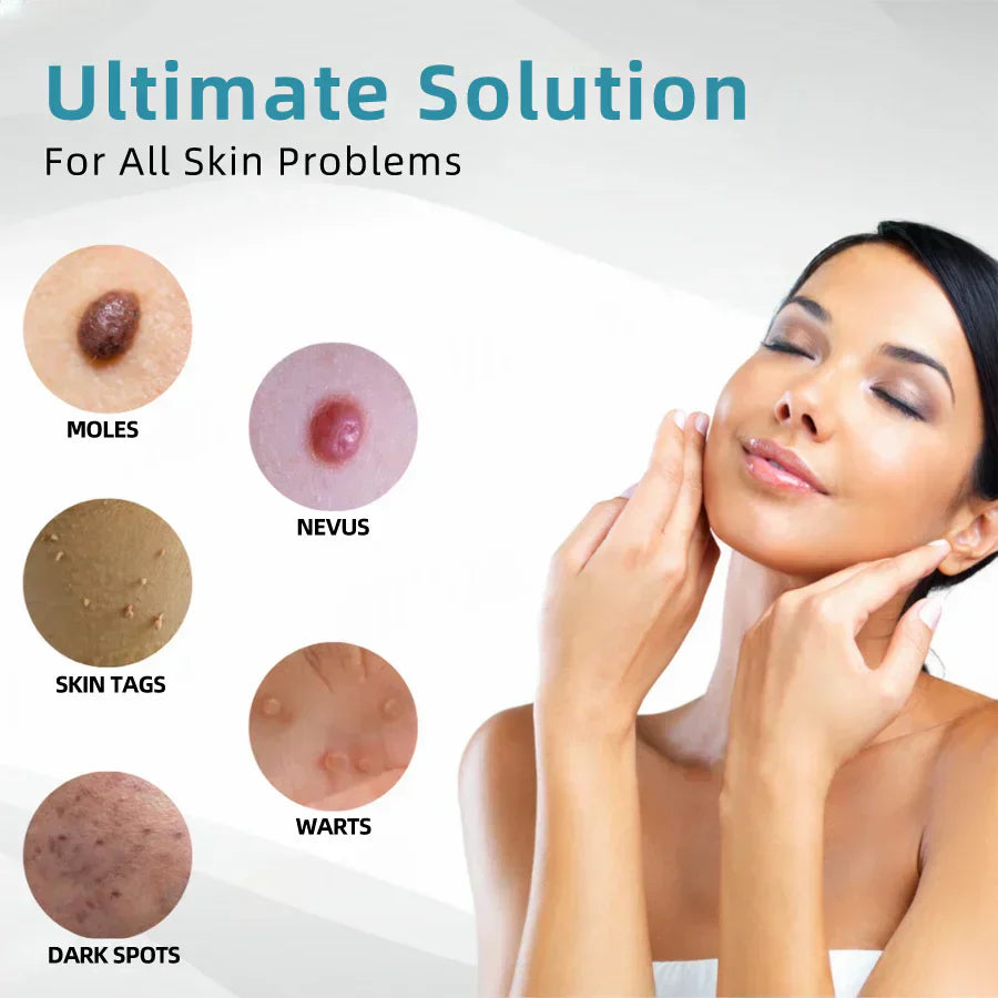 DedMuller®VelvetSkin+ Integrated laser eraser (powered by CO₂ laser technology - effectively removes moles, warts, skin labels, pigmentation spots and other skin defects)