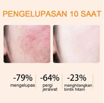 🌿BBOJI™ Das Orange Enzyme Peeling🌿-Gel – Das sanfte Wunder, nach dem Ihre Haut schreit