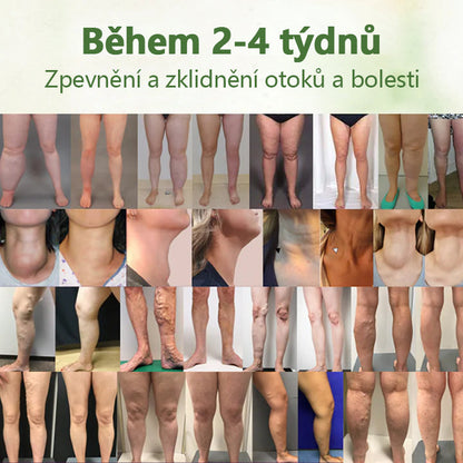 Cvreoz® Kräuter-Lymph-Entgiftungscreme schützt Ihre Gesundheit