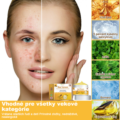 🧄𝑉𝑠𝑜𝑥𝑎™Velim Jędom Odsłanenij Bradavič Krém Znamionok (🧑‍⚕️AAD odporúča)🐝🐝(🔥Akcia na posledný deň - 80% zľava💒)🥔