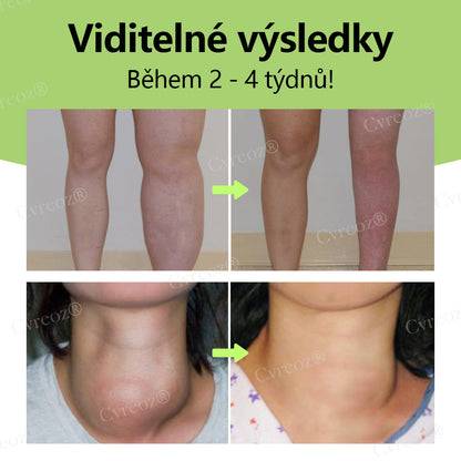Cvreoz® Kräuter-Lymph-Entgiftungscreme schützt Ihre Gesundheit