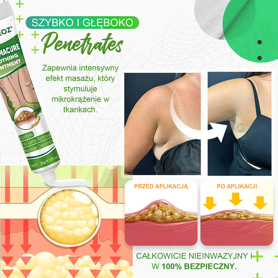 Cvreoz® Soothing Ointment behandelt Lipome problemlos und erzielt innerhalb von 2 Wochen eine deutliche Verbesserung
