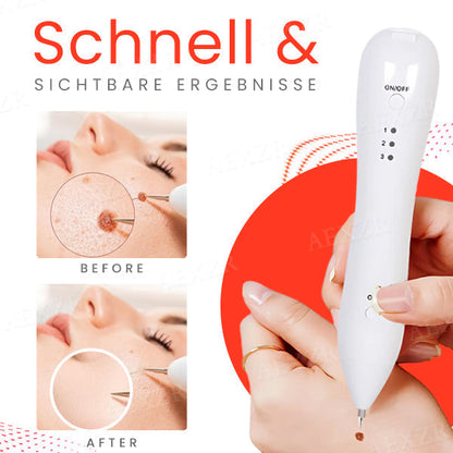 Fivfivgo™ Tragbarer Hautpflege-Laserstift
