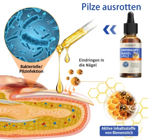Furzero  Bee Venom Nagelpilz Behandlungsléisung