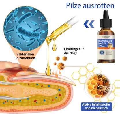 Furzero  Bee Venom Nagelpilz Behandlungsléisung