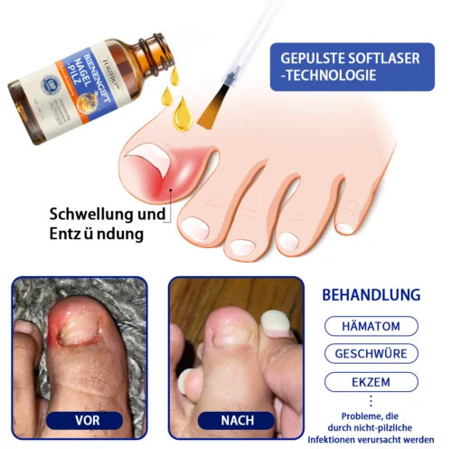 Furzero  Bee Venom Nagelpilz Behandlungsléisung