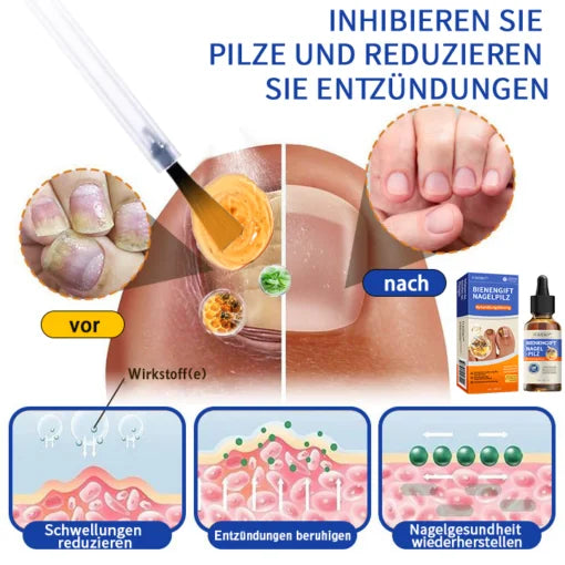 Furzero  Bee Venom Nagelpilz Behandlungsléisung
