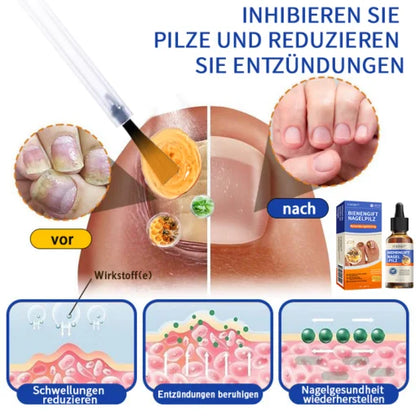 Furzero  Bee Venom Nagelpilz Behandlungsléisung
