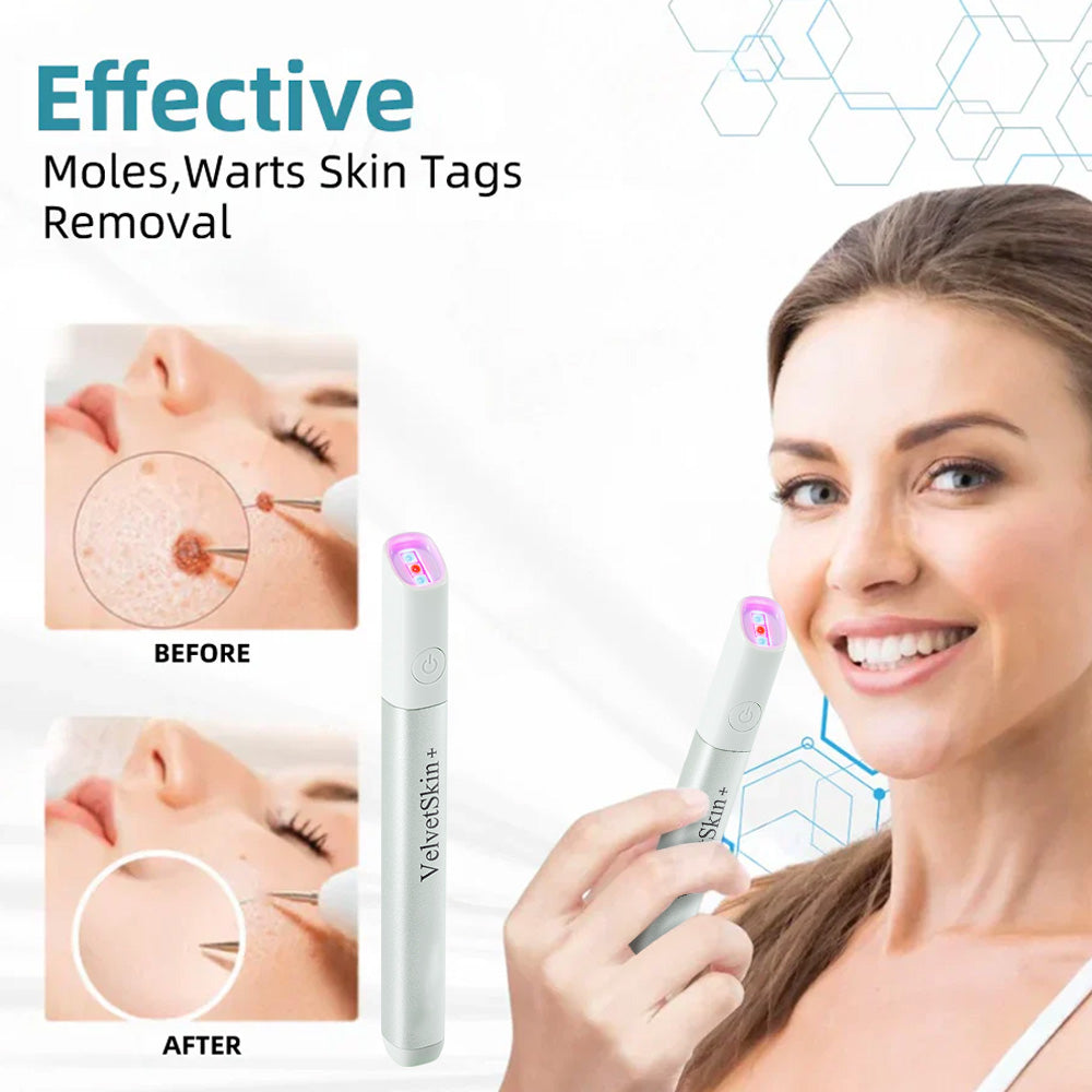 DedMuller®VelvetSkin+ Integrated laser eraser (powered by CO₂ laser technology - effectively removes moles, warts, skin labels, pigmentation spots and other skin defects)
