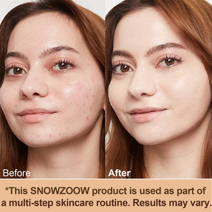 🔥Das heißeste Produkt von TikTok🔥 Feuchtigkeitsspendende 4-in-1-Concealer-Foundation – bionische Farbveränderung im mittleren Spektrum, langanhaltendes Make-up