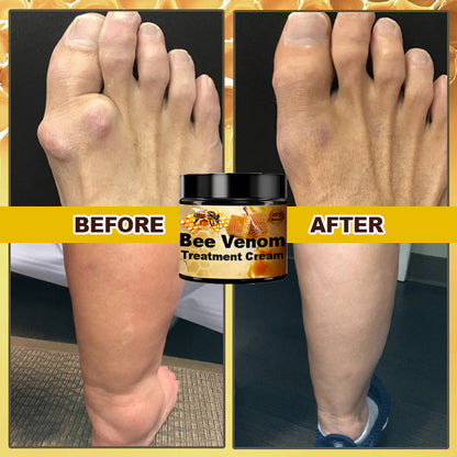 Arthritis Treatment Bee Venom Cream