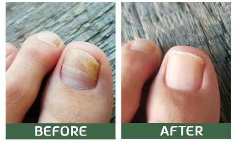 LOVILDSTM Chipikiri Chekudzivirira Nyuchi Uturu Kurapa Serum