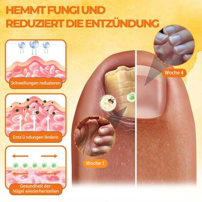 2025New - 𝗖𝘃𝗿𝗲𝗼𝘇® 𝗕𝗶𝗲𝗻𝗲𝗻𝗴𝗶𝗳𝘁 𝗡𝗮𝗴𝗲𝗹-𝗥𝗲𝗽𝗮𝗿𝗮𝘁𝘂𝗿 𝗦𝗽𝗿𝗮𝘆